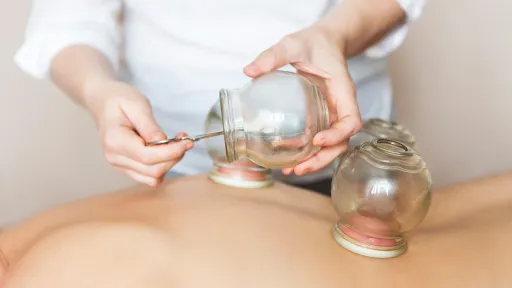 cupping back