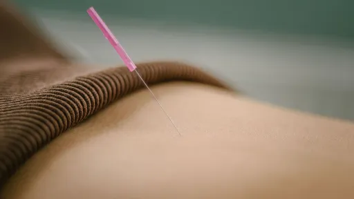 Needle inserted in lower abdomen