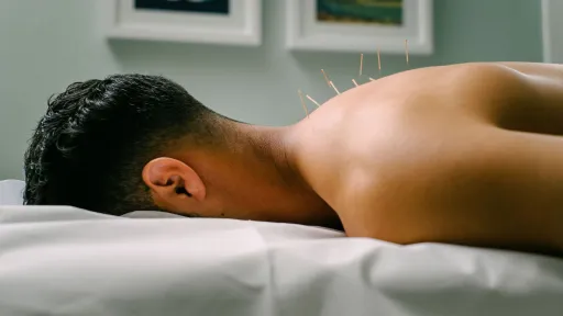 Neck and shoulder with needles in the back