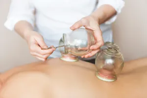 cupping back